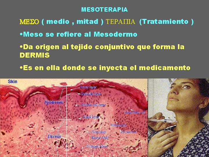 MESOTERAPIA MESO ( medio , mitad ) TERAPIA (Tratamiento ) • Meso se refiere MESOTERAPIA MESO ( medio , mitad ) TERAPIA (Tratamiento ) • Meso se refiere