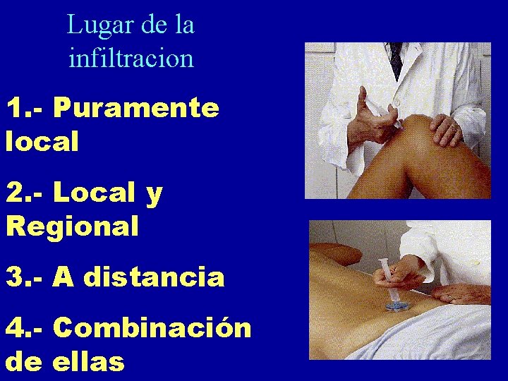 Lugar de la infiltracion 1. - Puramente local 2. - Local y Regional 3. Lugar de la infiltracion 1. - Puramente local 2. - Local y Regional 3.