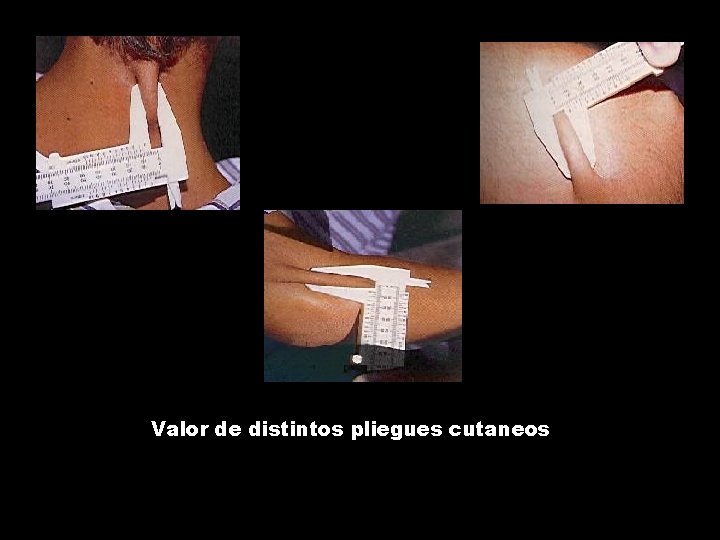 Valor de distintos pliegues cutaneos Valor de distintos pliegues cutaneos