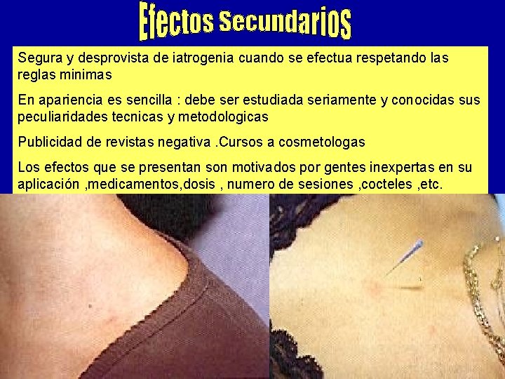 Segura y desprovista de iatrogenia cuando se efectua respetando las reglas minimas En apariencia Segura y desprovista de iatrogenia cuando se efectua respetando las reglas minimas En apariencia