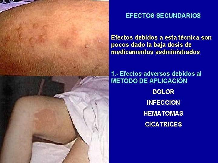 EFECTOS SECUNDARIOS Efectos debidos a esta técnica son pocos dado la baja dosis de EFECTOS SECUNDARIOS Efectos debidos a esta técnica son pocos dado la baja dosis de