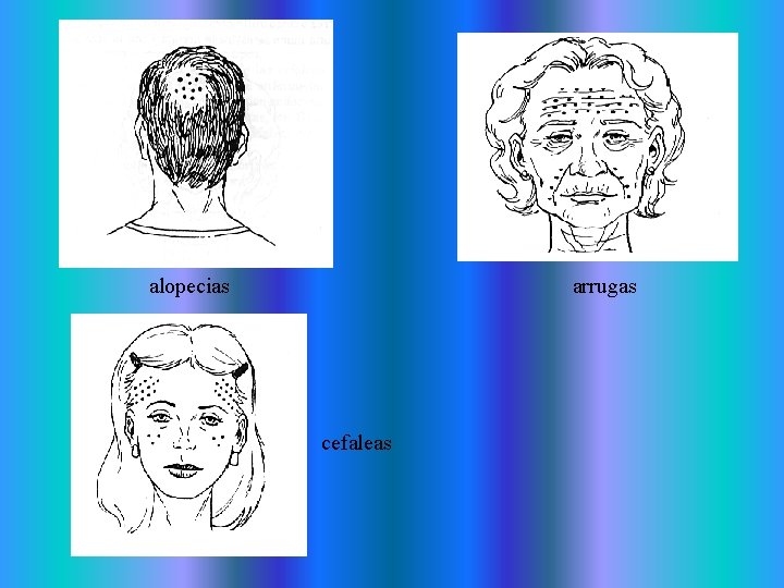 alopecias arrugas cefaleas alopecias arrugas cefaleas