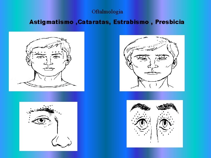Oftalmologia Astigmatismo , Cataratas, Estrabismo , Presbicia Oftalmologia Astigmatismo , Cataratas, Estrabismo , Presbicia