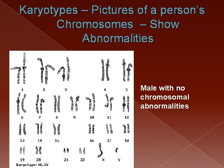 Karyotypes – Pictures of a person’s Chromosomes – Show Abnormalities Male with no chromosomal