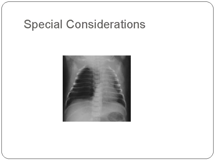 Special Considerations 