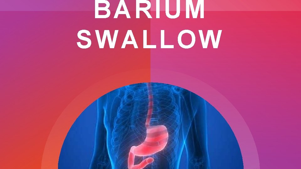 BARIUM SWALLOW 