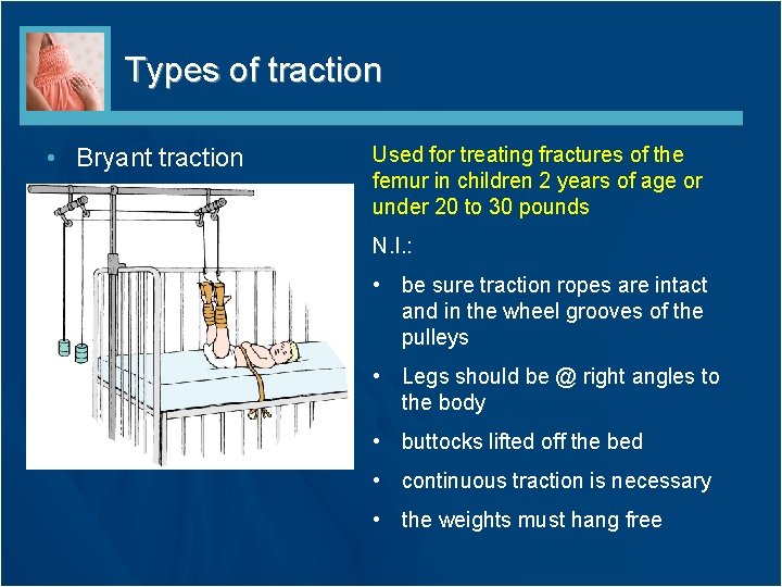 Types of traction • Bryant traction Used for treating fractures of the femur in