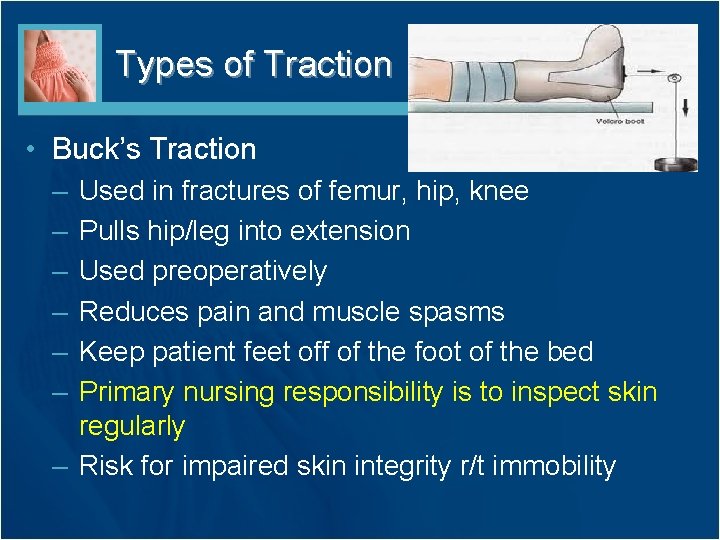 Types of Traction • Buck’s Traction – – – Used in fractures of femur,