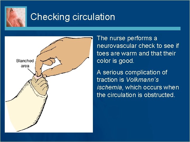 Checking circulation The nurse performs a neurovascular check to see if toes are warm
