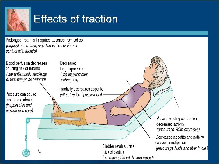 Effects of traction 