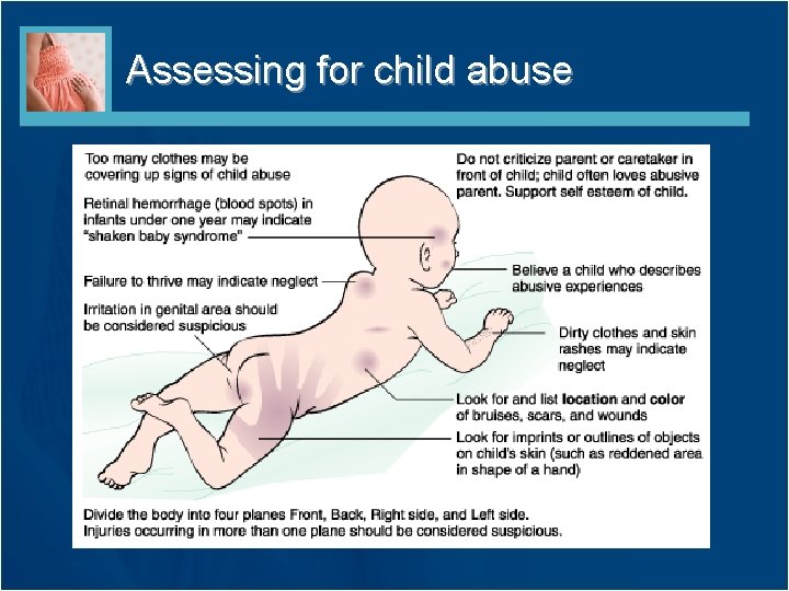 Assessing for child abuse 