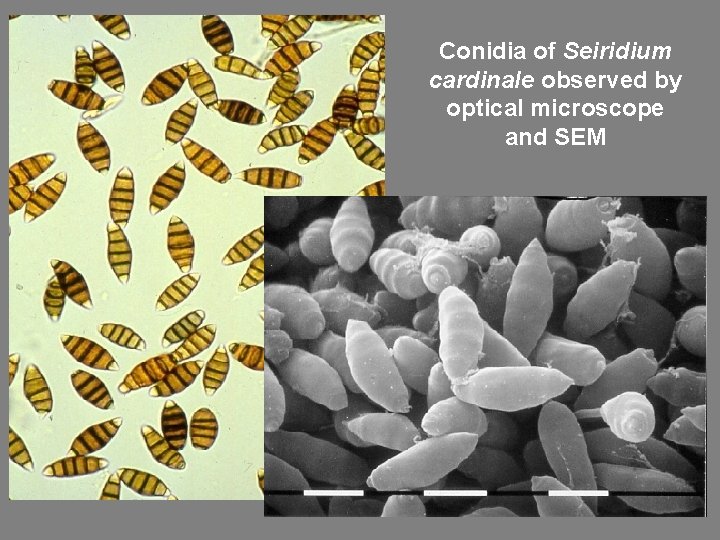 Conidia of Seiridium cardinale observed by optical microscope and SEM 