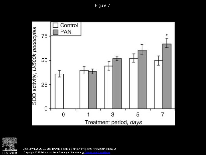 Figure 7 Kidney International 2004 661881 -1889 DOI: (10. 1111/j. 1523 -1755. 2004. 00962.