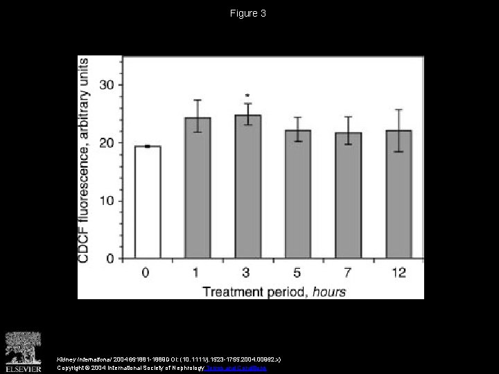 Figure 3 Kidney International 2004 661881 -1889 DOI: (10. 1111/j. 1523 -1755. 2004. 00962.