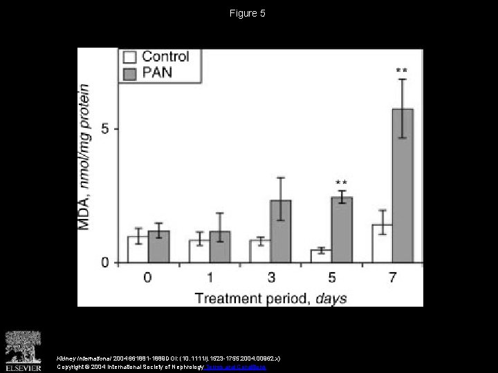 Figure 5 Kidney International 2004 661881 -1889 DOI: (10. 1111/j. 1523 -1755. 2004. 00962.