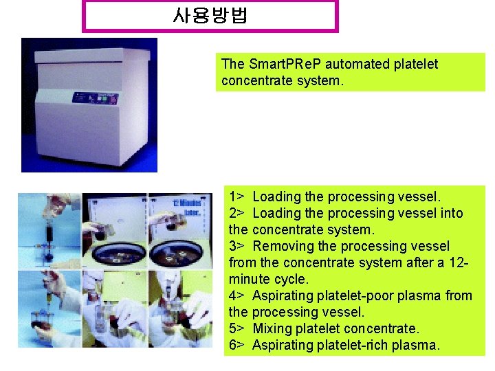 사용방법 The Smart. PRe. P automated platelet concentrate system. 1> Loading the processing vessel.