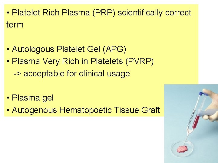  • Platelet Rich Plasma (PRP) scientifically correct term • Autologous Platelet Gel (APG)