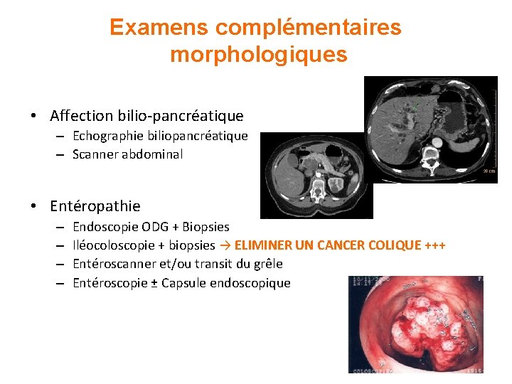 Examens complémentaires morphologiques • Affection bilio-pancréatique – Echographie biliopancréatique – Scanner abdominal • Entéropathie