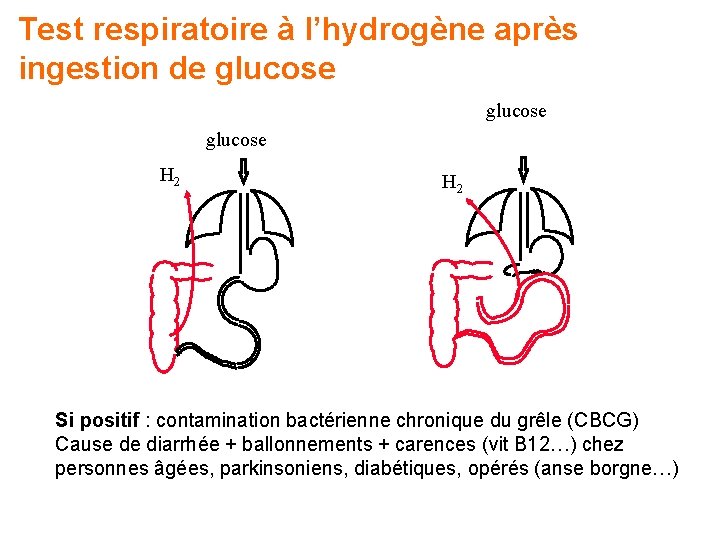 Test respiratoire à l’hydrogène après ingestion de glucose H 2 Si positif : contamination