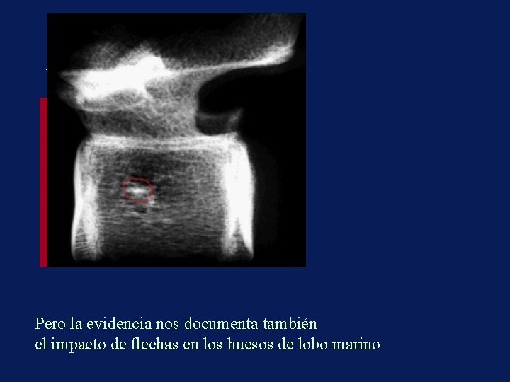 vértebra con flechazo lateral Pero la evidencia nos documenta también el impacto de flechas