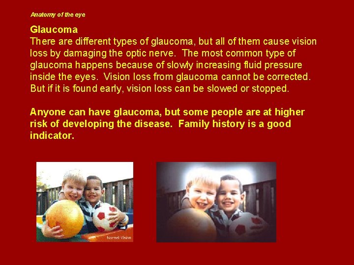 Anatomy of the eye Glaucoma There are different types of glaucoma, but all of