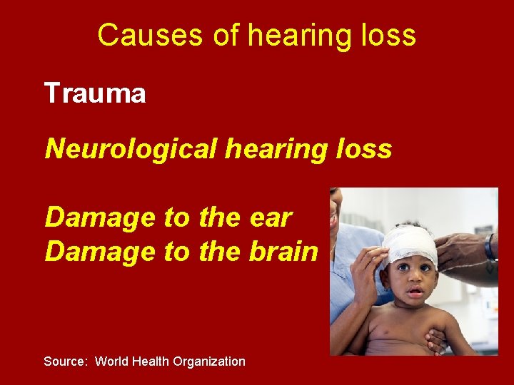 Causes of hearing loss Trauma Neurological hearing loss Damage to the ear Damage to