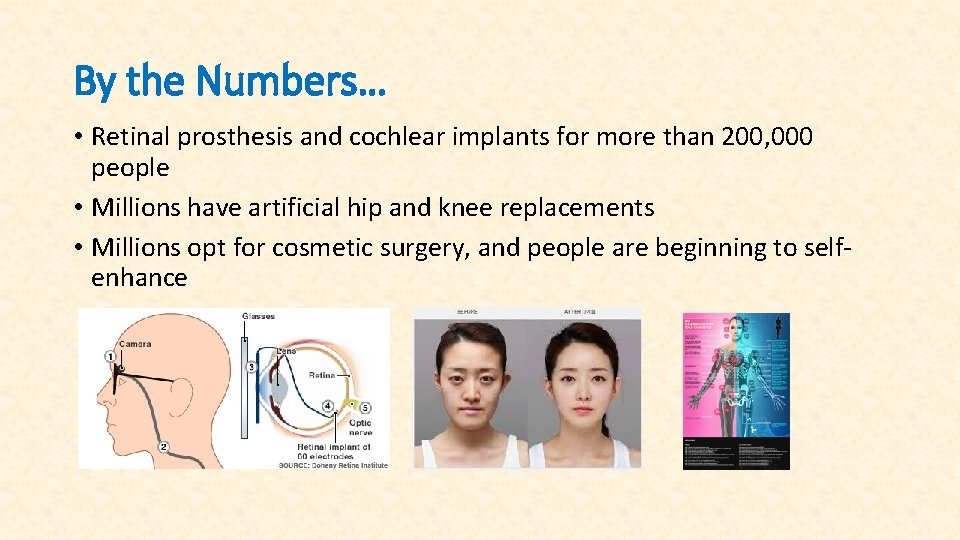By the Numbers… • Retinal prosthesis and cochlear implants for more than 200, 000