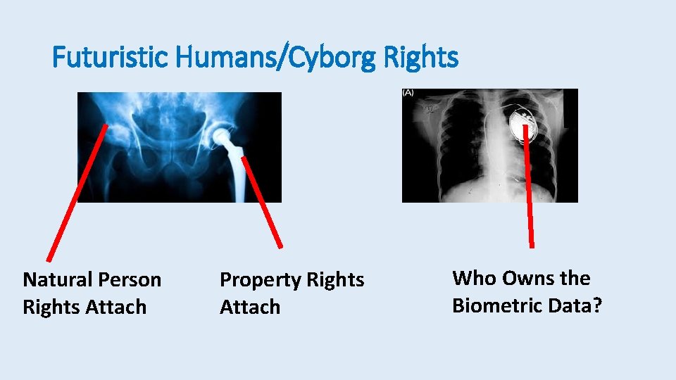 Futuristic Humans/Cyborg Rights Natural Person Rights Attach Property Rights Attach Who Owns the Biometric