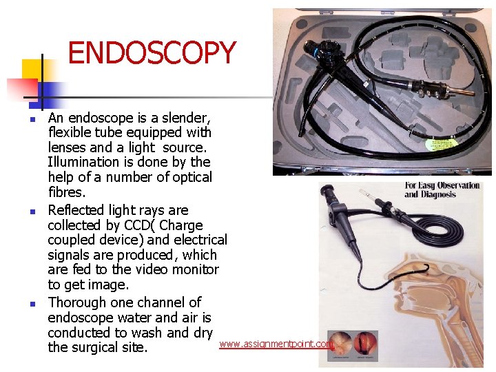 ENDOSCOPY n n n An endoscope is a slender, flexible tube equipped with lenses