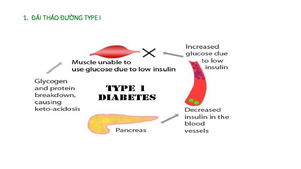 1. ĐÁI THÁO ĐƯỜNG TYPE I 