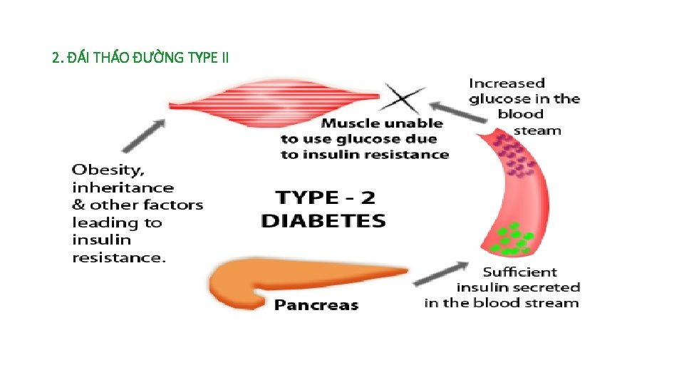 2. ĐÁI THÁO ĐƯỜNG TYPE II 