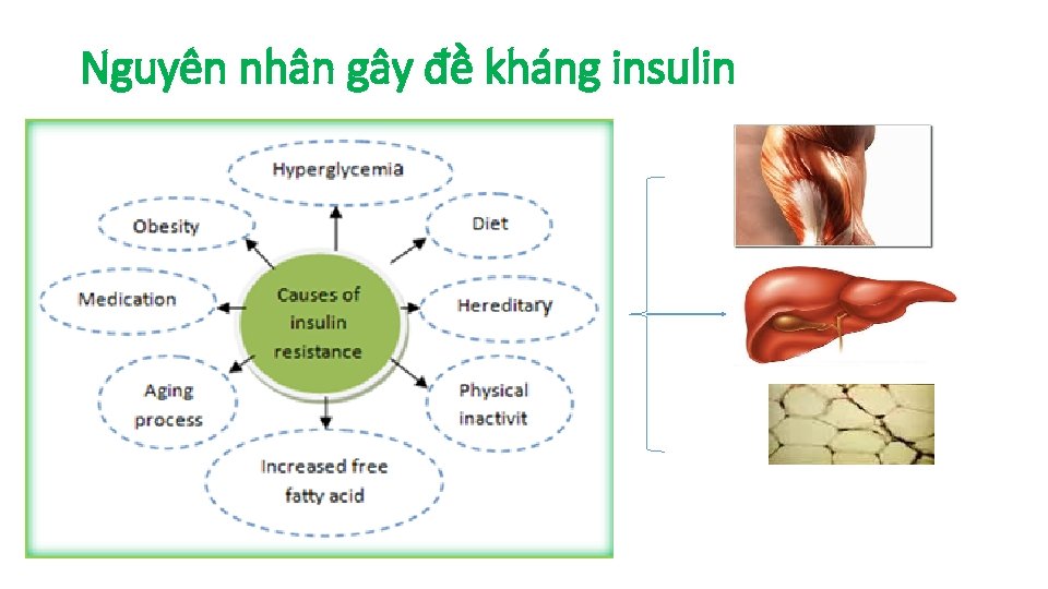 Nguyên nhân gây đề kháng insulin 