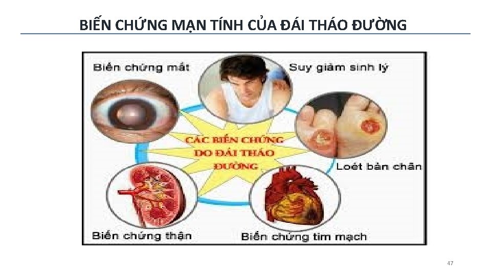 BIẾN CHỨNG MẠN TÍNH CỦA ĐÁI THÁO ĐƯỜNG 47 