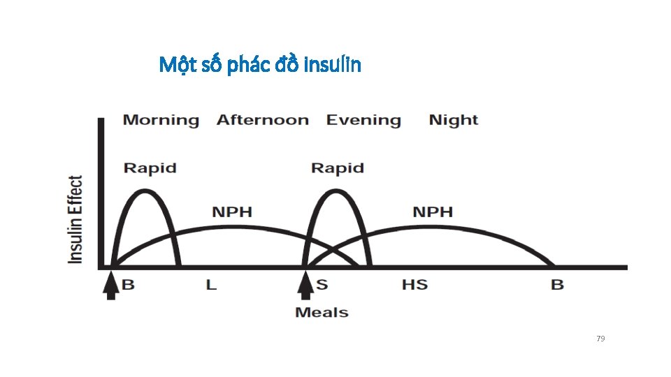 Một số phác đồ insulin 79 