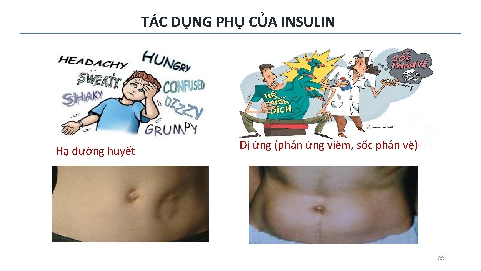 TÁC DỤNG PHỤ CỦA INSULIN Hạ đường huyết Dị ứng (phản ứng viêm, sốc