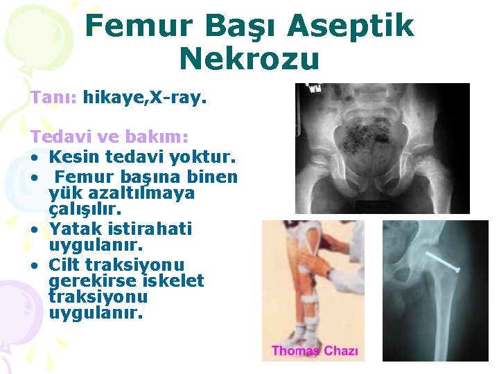 Femur Başı Aseptik Nekrozu Tanı: hikaye, X-ray. Tedavi ve bakım: • Kesin tedavi yoktur.