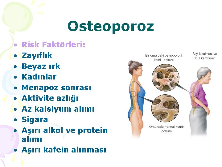 Osteoporoz • • • Risk Faktörleri: Zayıflık Beyaz ırk Kadınlar Menapoz sonrası Aktivite azlığı