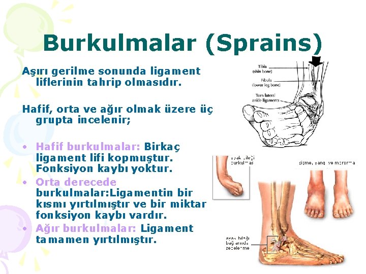 Burkulmalar (Sprains) Aşırı gerilme sonunda ligament liflerinin tahrip olmasıdır. Hafif, orta ve ağır olmak