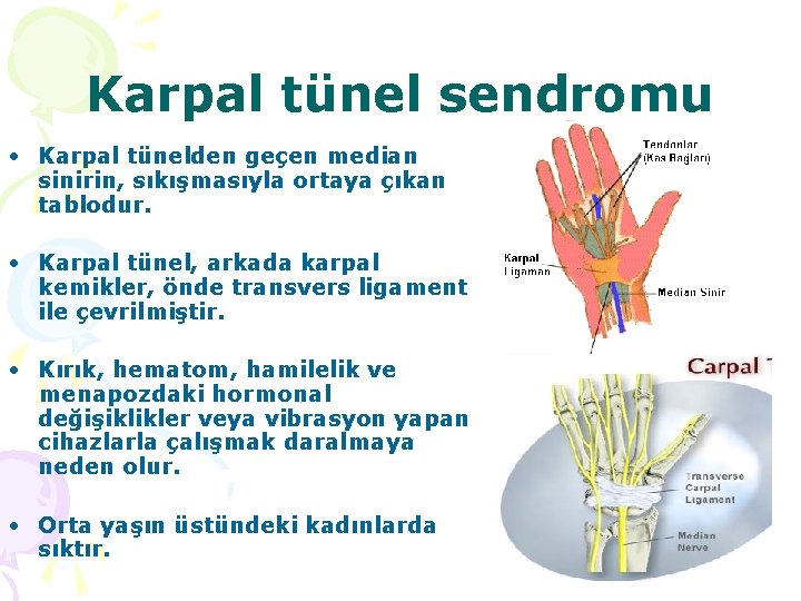 Karpal tünel sendromu • Karpal tünelden geçen median sinirin, sıkışmasıyla ortaya çıkan tablodur. •