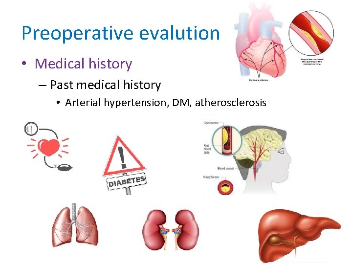 Preoperative evalution • Medical history – Past medical history • Arterial hypertension, DM, atherosclerosis