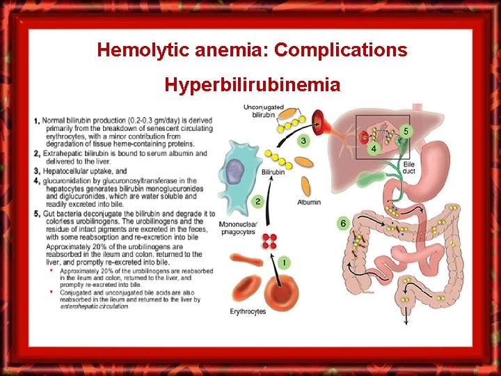 Hemolytic anemia: Complications Hyperbilirubinemia 
