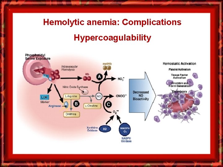 Hemolytic anemia: Complications Hypercoagulability 