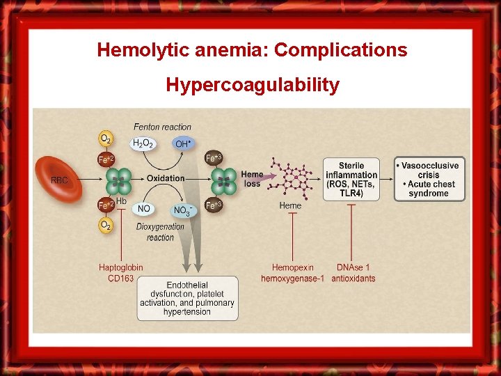 Hemolytic anemia: Complications Hypercoagulability 