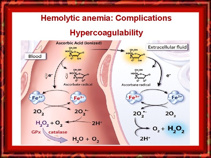 Hemolytic anemia: Complications Hypercoagulability 