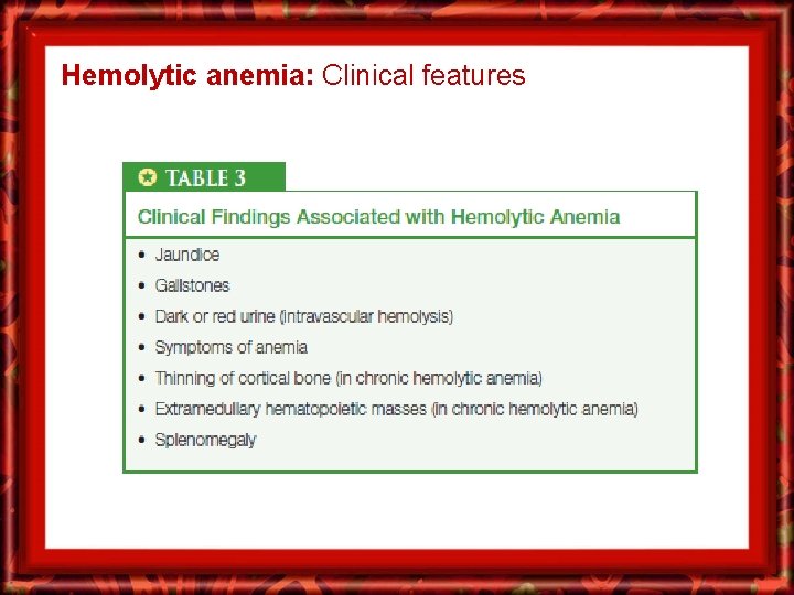Hemolytic anemia: Clinical features 