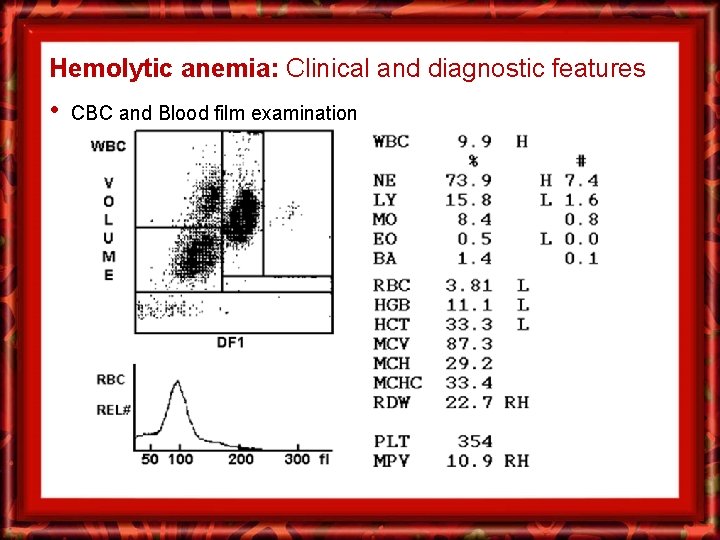 Hemolytic anemia: Clinical and diagnostic features • CBC and Blood film examination 