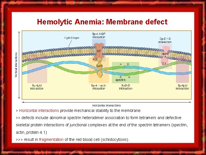 Hemolytic Anemia: Membrane defect > Horizontal interactions provide mechanical stability to the membrane. >>