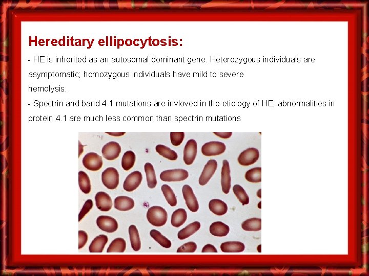 Hereditary ellipocytosis: - HE is inherited as an autosomal dominant gene. Heterozygous individuals are