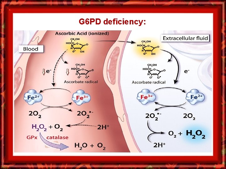 G 6 PD deficiency: 