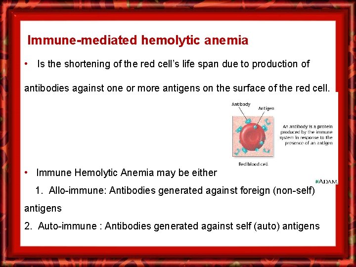 Immune-mediated hemolytic anemia • Is the shortening of the red cell’s life span due
